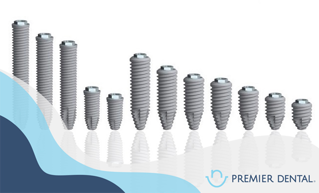 Răng implant có gây dị ứng không